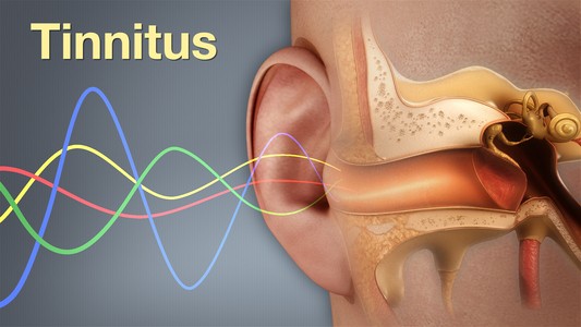 Tinnitus care specialists in Faridabad